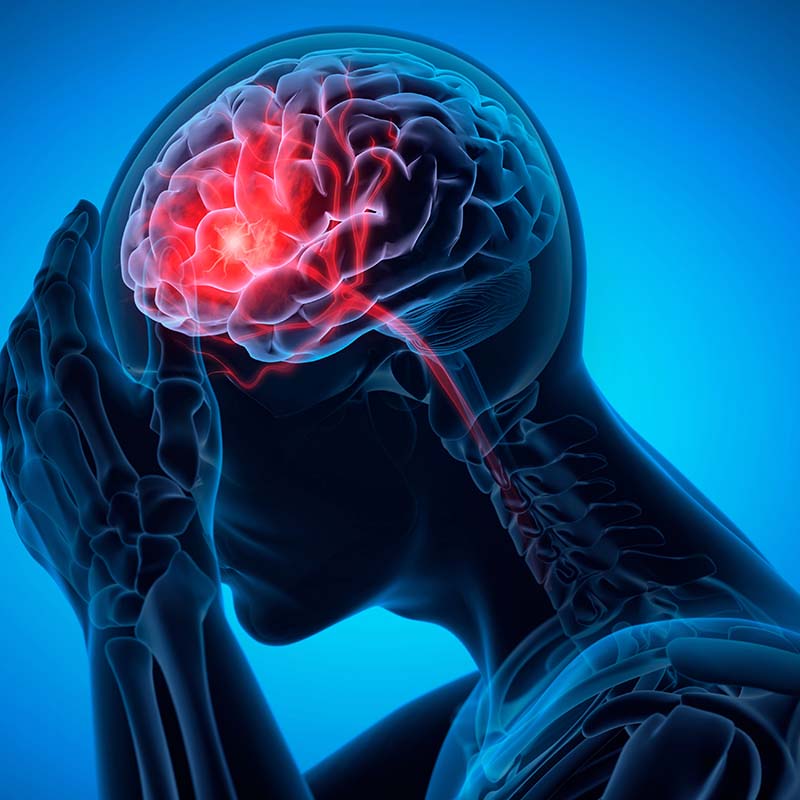 Man with a headache -  Brain Stroke - 3D Illustration